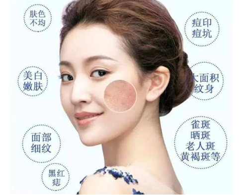 皮秒會(huì)反黑嗎 這是正?，F(xiàn)象