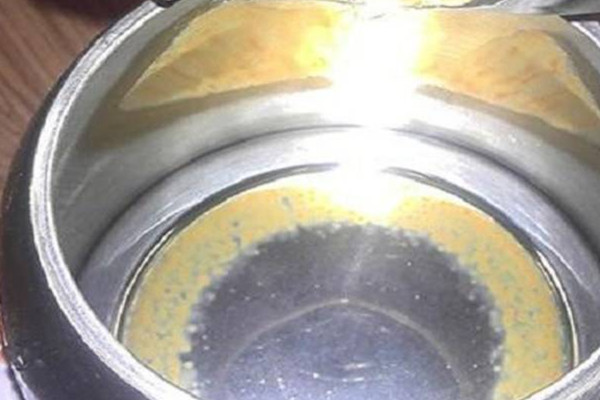 水垢會導致腎結(jié)石嗎 水垢對身體的影響