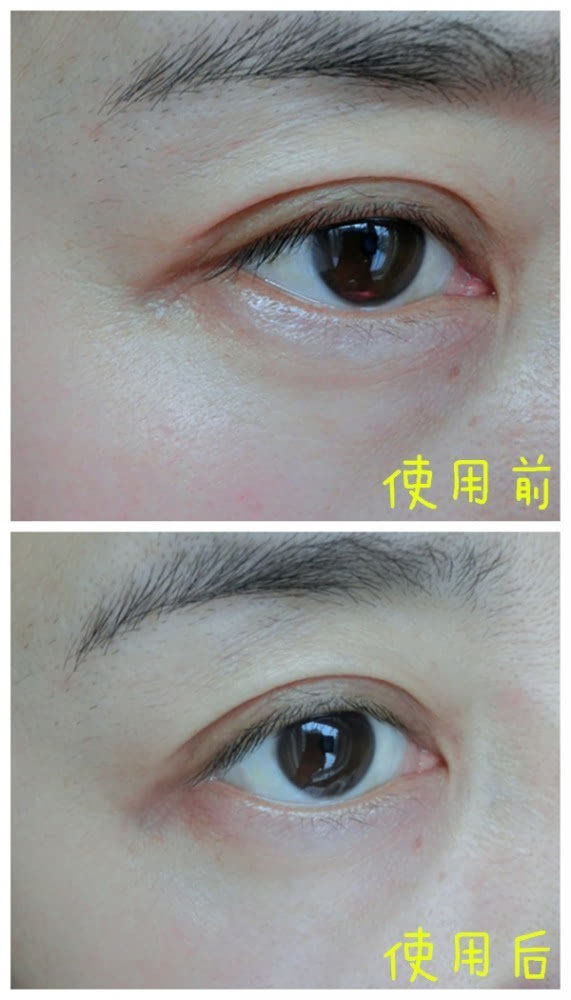VIIcode夜間氧眼貼抗老效果怎么樣？VIIcode眼膜使用測(cè)評(píng)