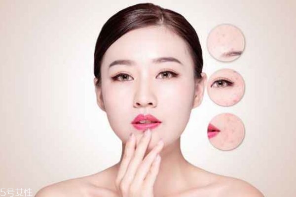 涂完粉底毛孔里都是白色點(diǎn)點(diǎn) 化妝時毛孔里都是粉