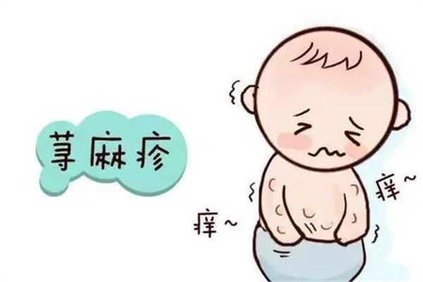 蕁麻疹老是反復發(fā)作怎么回事 蕁麻疹反復發(fā)作怎么才能根除