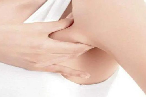 副乳切除手術(shù)是全麻還是局麻 副乳切除手術(shù)后多久可以正?；顒?dòng)